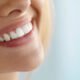 What is the Most Popular Cosmetic Dental Procedure?